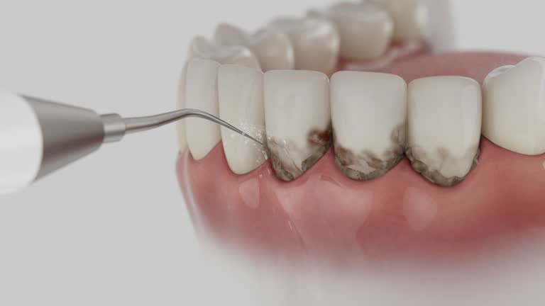Reliable Dental Implants contractor in Jarrell, TX by Smile Center Dentistry